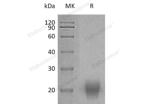 Recombinant Human FSH Protein (Flag & His Tag) - ABMIUM