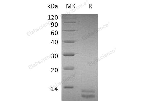 Recombinant Mouse CXCL1 Protein (His Tag) - ABMIUM