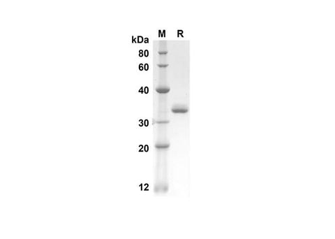 SDS-PAGE analysis of Porcine COL2A1 proteins, 2 μg/lane of Recombinant Porcine COL2A1 proteins was resolved with an SDS-PAGE under reducing conditions, showing bands at 25.7 kDa.
