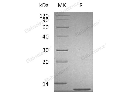 Recombinant Mouse CCL2/MCP-1 Protein - ABMIUM