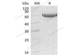 Recombinant Human Carboxypeptidase B2/CPB2 Protein (His Tag) - ABMIUM