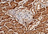Anti-Human ACY1 Antibody [B265]