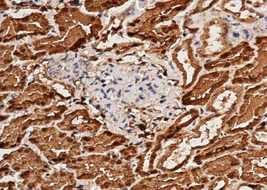 Anti-Human ACY1 Antibody [B265] - ABMIUM