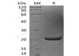 > 98 % as determined by reducing SDS-PAGE.