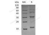 Recombinant Human UBE2D3 Protein - ABMIUM
