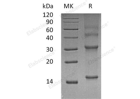 Recombinant Human UBE2D3 Protein - ABMIUM