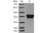 Recombinant Human STIM1/GOK Protein (His Tag) - ABMIUM