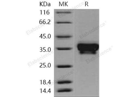 Recombinant Human STIM1/GOK Protein (His Tag) - ABMIUM