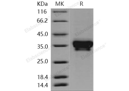 Recombinant Human STIM1/GOK Protein (His Tag) - ABMIUM