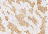 Anti-Human PMVK Antibody [B203]