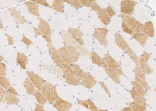 Anti-Human PMVK Antibody [B203] - ABMIUM