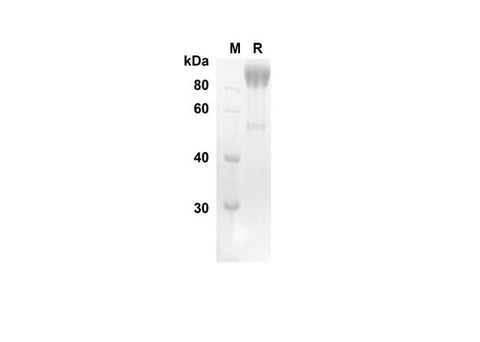 SDS-PAGE analysis of Human VCAM-1/CD106 proteins, 2 μg/lane of Recombinant Human VCAM-1/CD106 proteins was resolved with SDS-PAGE under reducing conditions, showing bands at 76.6 kDa.