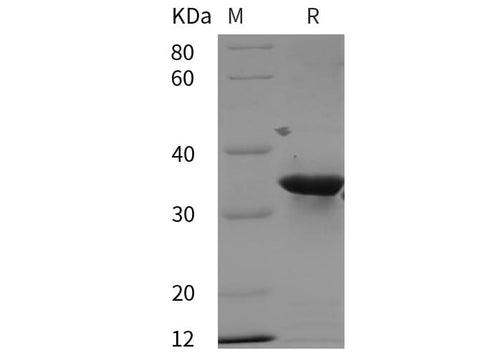 SDS-PAGE analysis of Human PRRG2 proteins, 2 μg/lane of Recombinant Human PRRG2 proteins was resolved with SDS-PAGE under reducing conditions, showing bands at 35 kDa.