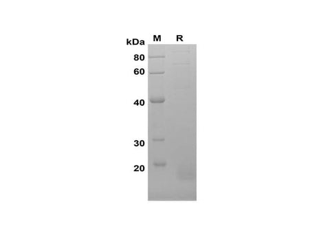SDS-PAGE analysis of Rat IL-4 proteins, 2 μg/lane of Recombinant Rat IL-4 proteins was resolved with SDS-PAGE under reducing conditions, showing bands at 17 kDa.