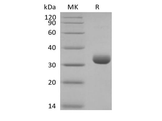 Recombinant Human Butyrophilin Subfamily 3 Member A2/BTN3A2 (C-6His-Avi) Biotinylated - ABMIUM