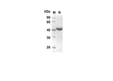 SDS-PAGE analysis of Human IVL proteins, 2 μg/lane of Recombinant Human IVL proteins was resolved with SDS-PAGE under reducing conditions, showing bands at 33.9 kDa.