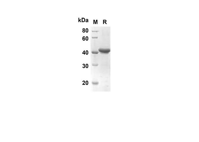 SDS-PAGE analysis of Human IVL proteins, 2 μg/lane of Recombinant Human IVL proteins was resolved with SDS-PAGE under reducing conditions, showing bands at 33.9 kDa.
