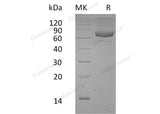 Recombinant Human PSG9/PSBG9 Protein (His Tag) - ABMIUM