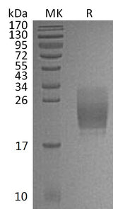 Recombinant Mouse CD160/BY55 Protein (His Tag) - ABMIUM