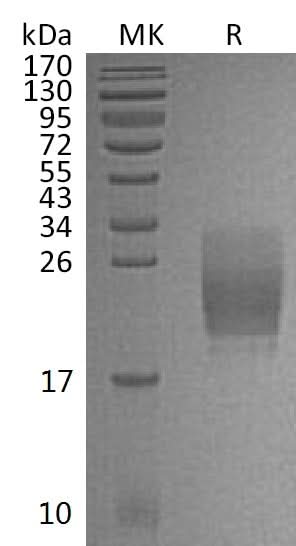Recombinant Mouse CD160/BY55 Protein (His Tag) - ABMIUM