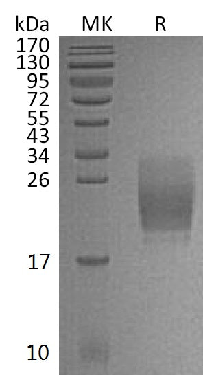 Recombinant Mouse CD160/BY55 Protein (His Tag) - ABMIUM