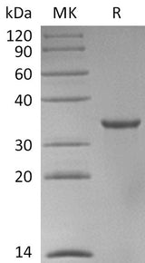Recombinant Human STUB1 Protein - ABMIUM
