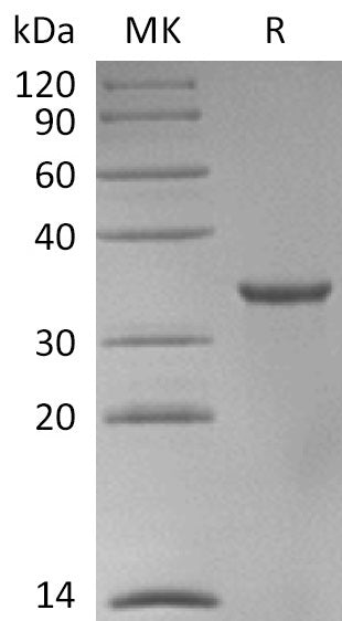 Recombinant Human STUB1 Protein - ABMIUM