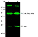 Anti-Human SOD2 Antibody [B178]