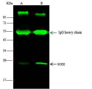 Anti-Human SOD2 Antibody [B178] - ABMIUM