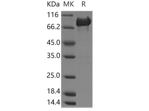 Recombinant Human PCK2 Protein (His & GST Tag) - ABMIUM