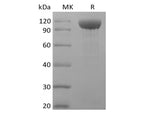 Recombinant Rhesus Macaque Angiopoietin-2/ANG2 (C-Fc) - ABMIUM