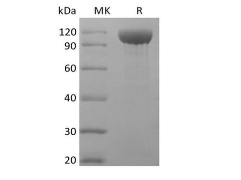Recombinant Rhesus Macaque Angiopoietin-2/ANG2 (C-Fc) - ABMIUM