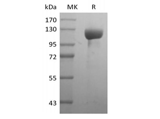 Recombinant Human Receptor Tyrosine-Protein Kinase ErbB-3/HER3 (C-Fc) - ABMIUM