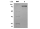 Recombinant Human Receptor Tyrosine-Protein Kinase ErbB-3/HER3 (C-6His) - ABMIUM