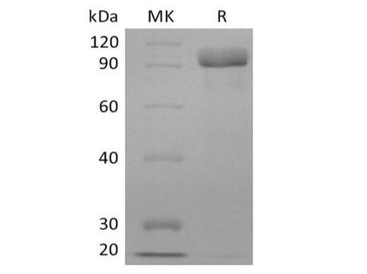 Recombinant Human Receptor Tyrosine-Protein Kinase ErbB-3/HER3 (C-6His) - ABMIUM