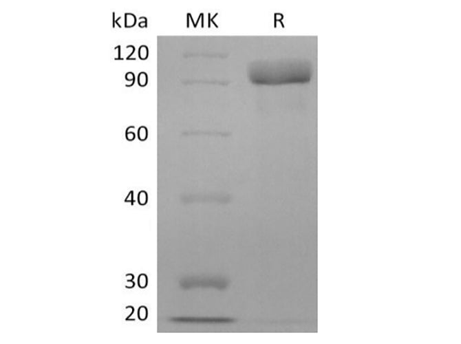 Recombinant Human Receptor Tyrosine-Protein Kinase ErbB-3/HER3 (C-6His) - ABMIUM