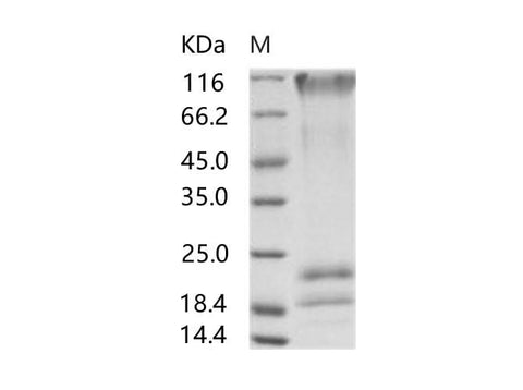 Recombinant EBOV (subtype Sudan, strain Gulu) GP / Glycoprotein Protein (His Tag) - ABMIUM