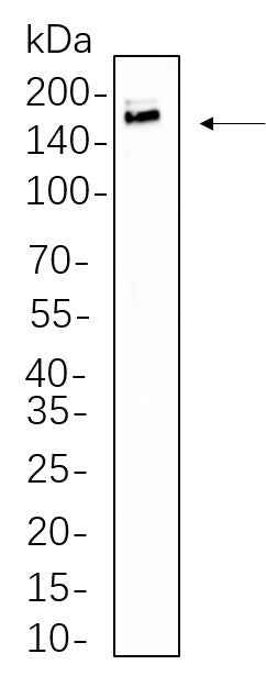 Anti-Human/Mouse/Rat/Pig IRS-1 Antibody [B1085] - ABMIUM