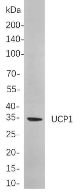 Anti-Mouse/Rat UCP1 Antibody [B814]