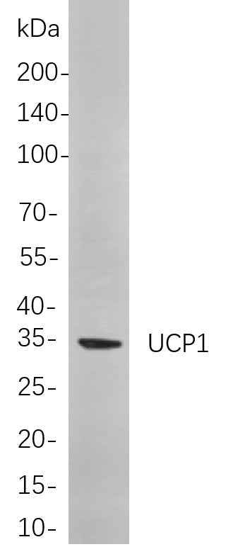 Anti-Mouse/Rat UCP1 Antibody [B814]