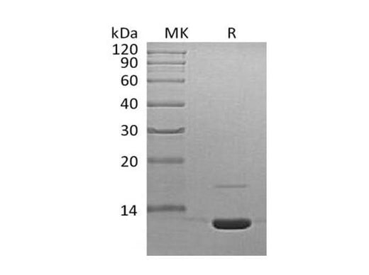 Recombinant Mouse Complement Component C3a/C3a Protein - ABMIUM