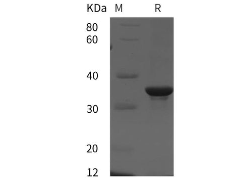 SDS-PAGE analysis of Human cyclin D3/CCND3 proteins, 2 μg/lane of Recombinant Human cyclin D3/CCND3 proteins was resolved with SDS-PAGE under reducing conditions, showing bands at 35 kDa.