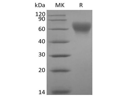 Recombinant Human B7-2/CD86 (C-Avi-6His) Biotinylated - ABMIUM