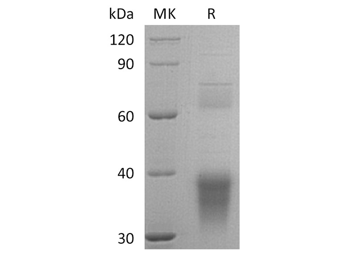 Recombinant Human Clusterin/ApoJ Protein (aa 23-449, His Tag) - ABMIUM