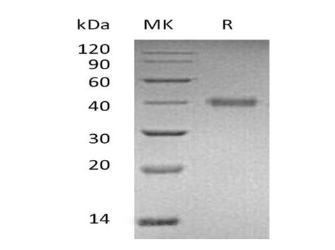 Recombinant Human R-Spondin 1/RSPO1 Protein (His Tag) - ABMIUM