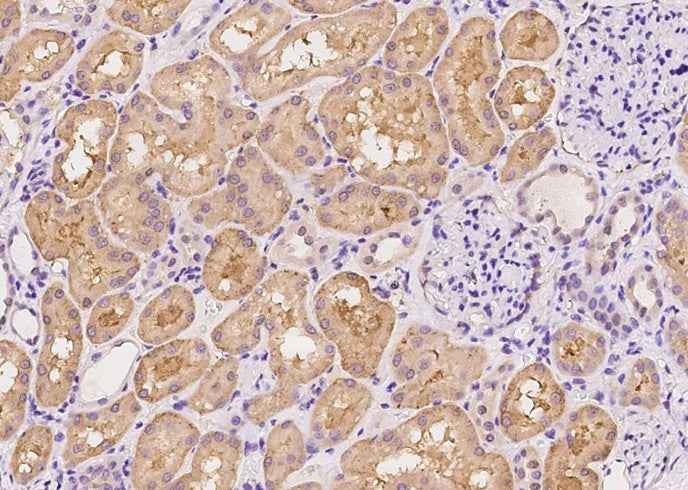 Anti-Human SDC1 Antibody [B326] - ABMIUM