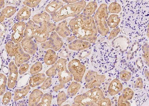 Anti-Human SDC1 Antibody [B326] - ABMIUM