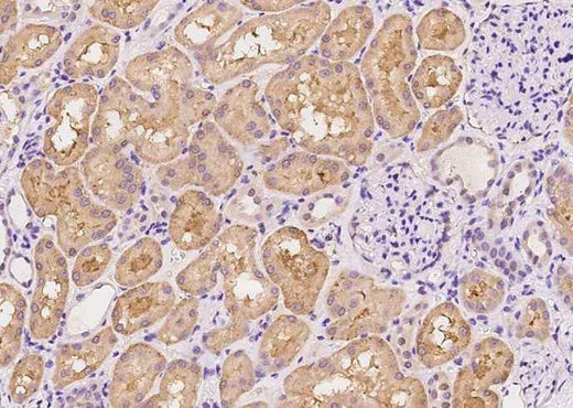 Anti-Human SDC1 Antibody [B326] - ABMIUM