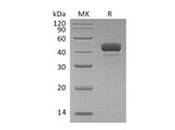 Recombinant Human Reticulocalbin 3/RCN3 Protein (aa 21-328, His Tag) - ABMIUM