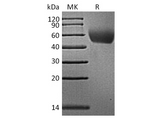 Recombinant Rhesus macaque CD155/PVR/NECL5 Protein (His Tag) - ABMIUM